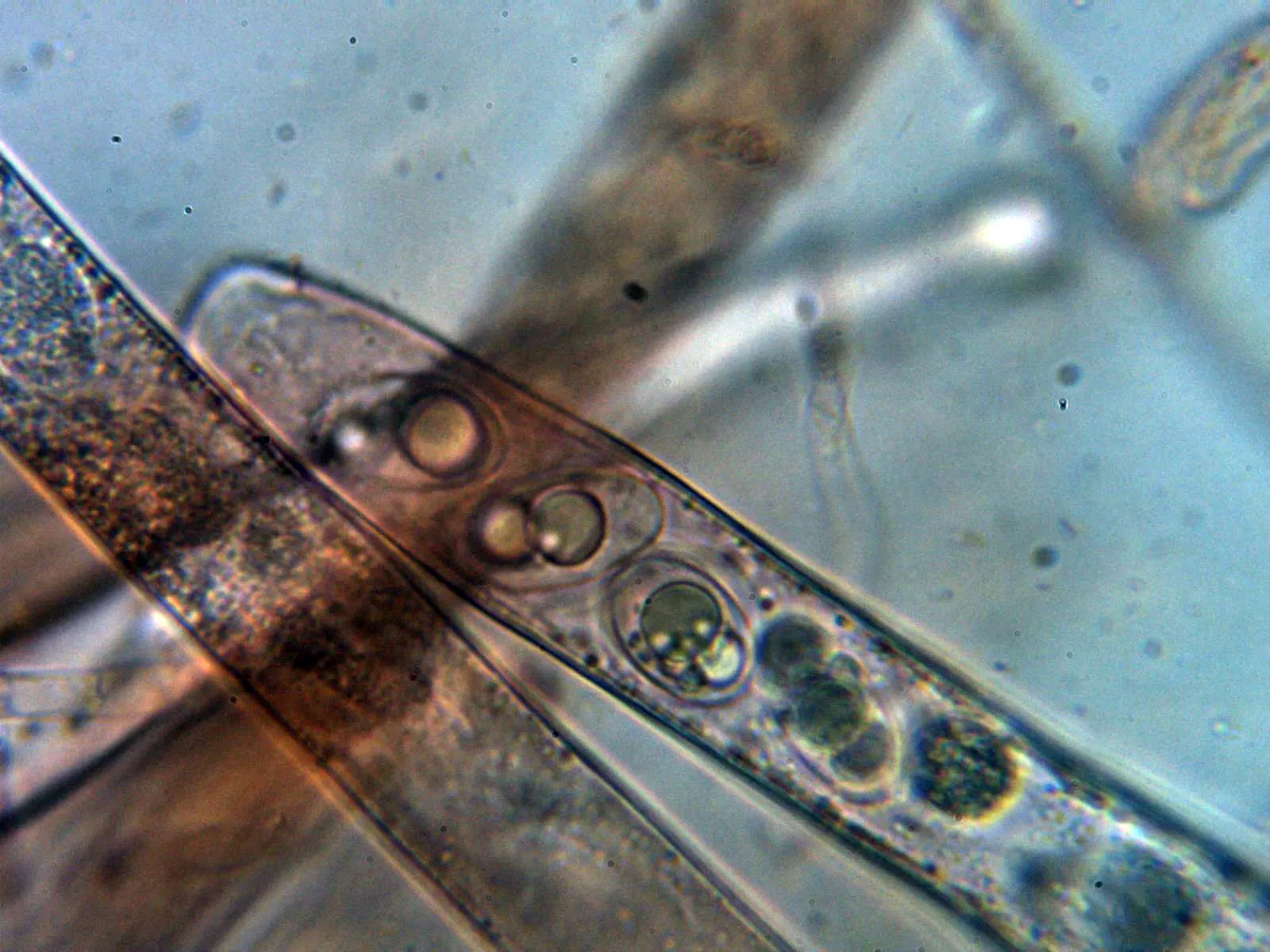 Microscopía de Paragalactinia succosa - 10 - Asco 1